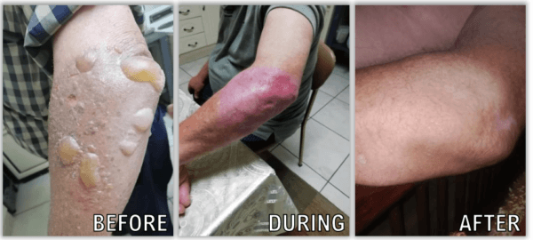 From Injury to Healing: A True Story